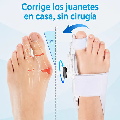 Corrector de Juanetes | Lo Corrige Desde Casa Sin Cirugías - Sin Dolor - Sin Medicamentos